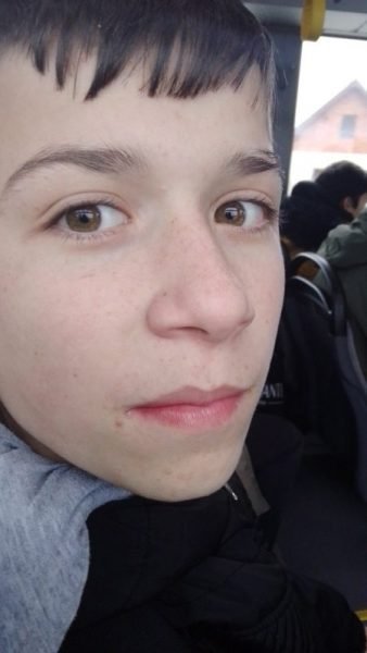 Aleksandru (14) je potreban inhalator 1 Aleksandru (14) je potreban inhalator 1