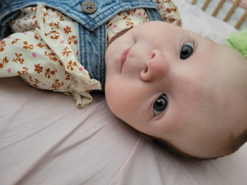 Bebi Irini Trojanovski je hitno potrebna pomoć svih nas! 2 Bebi Irini Trojanovski je hitno potrebna pomoć svih nas! 2